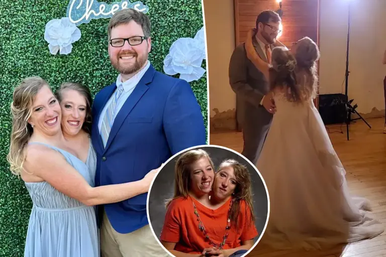 The Incredible Journey of Abby and Brittany Hensel image 1