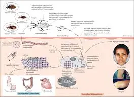 Understanding Chagas Disease: Impact and Prevention