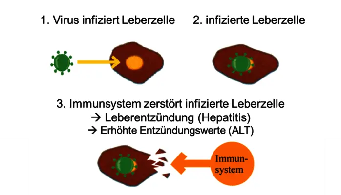 Tout sur l’hépatite B : Un problème de santé mondiale