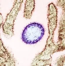 What You Need to Know About Nipah Virus image 1