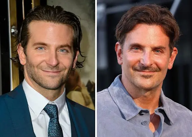 Bradley Cooper’s Facelift: What’s Behind the Recent Buzz?