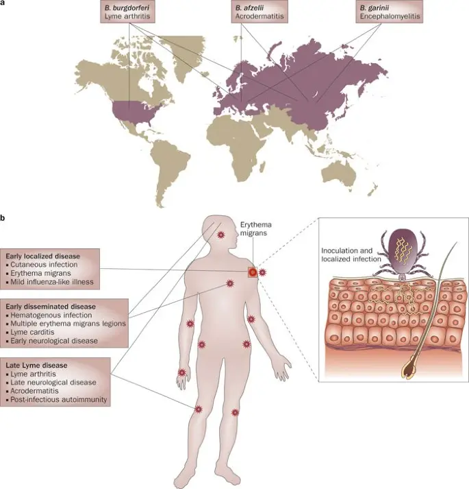 Understanding Lyme Disease: Symptoms and Prevention